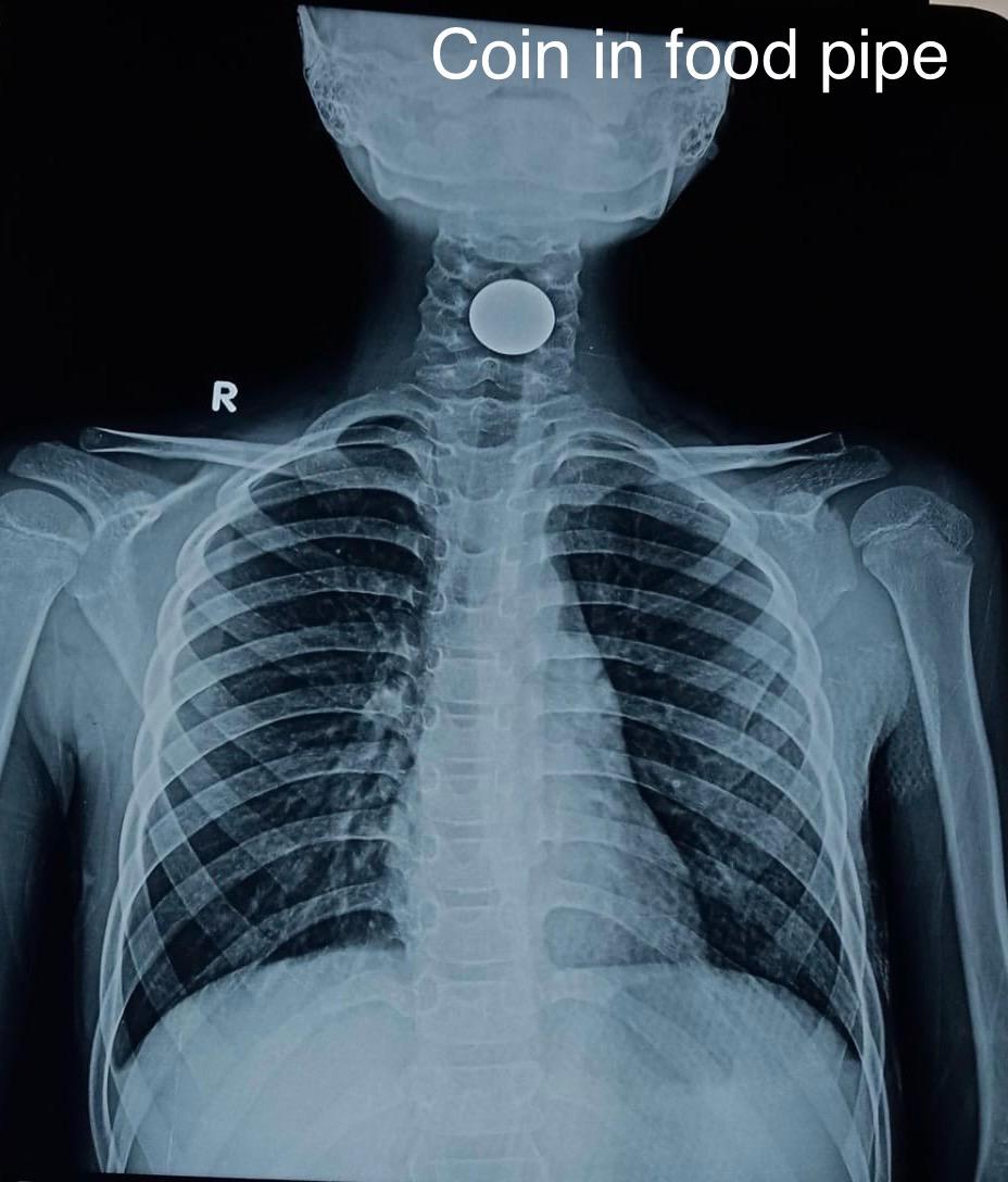 ENT gallery 2026-01-04 at 11.55.37